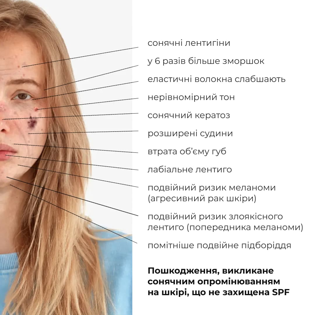 Комплекс для освітлення пігментації та захисту від фотостаріння thumbnail