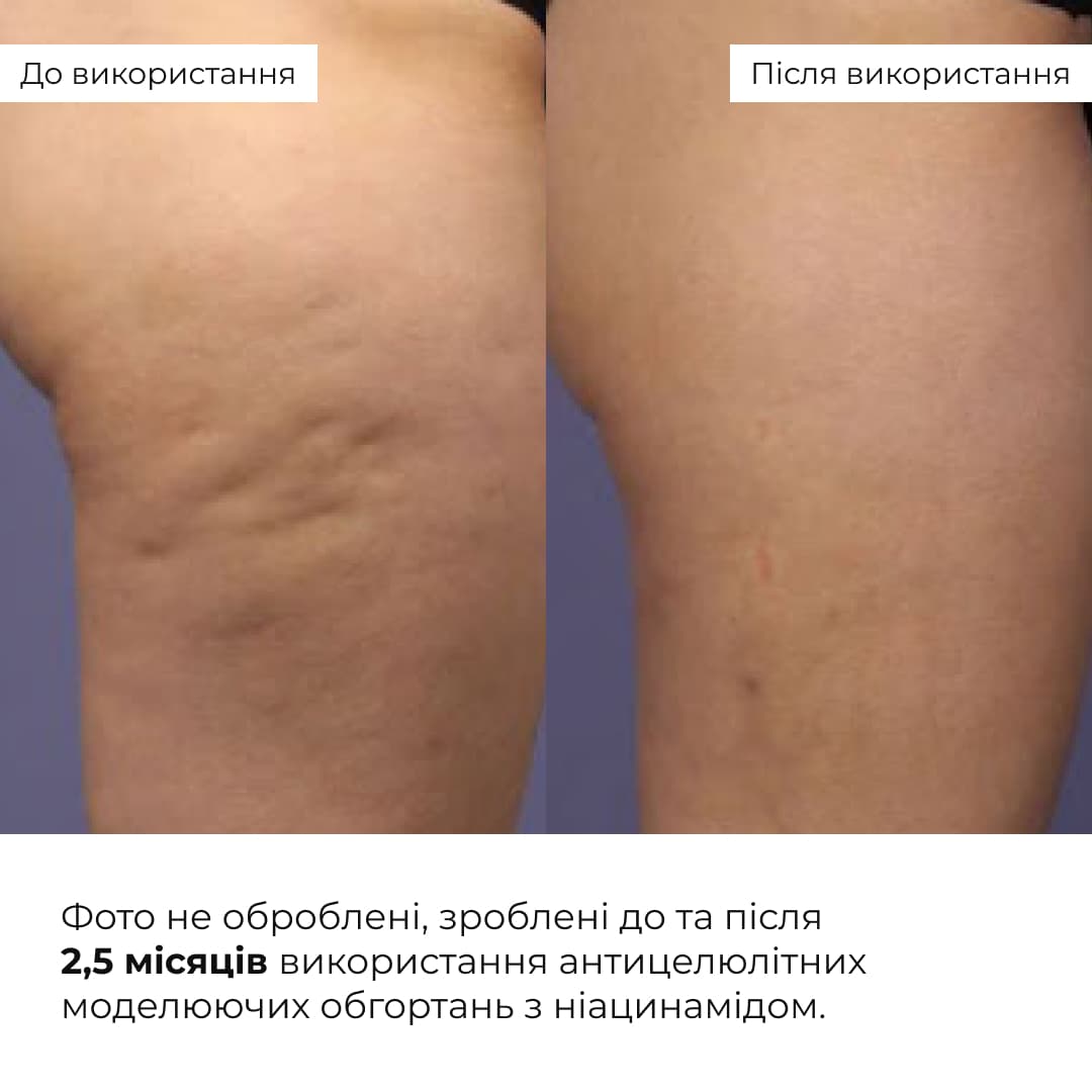 Курс антицелюлітних моделюючих обгортань з ніацинамідом, 6 уп. thumbnail