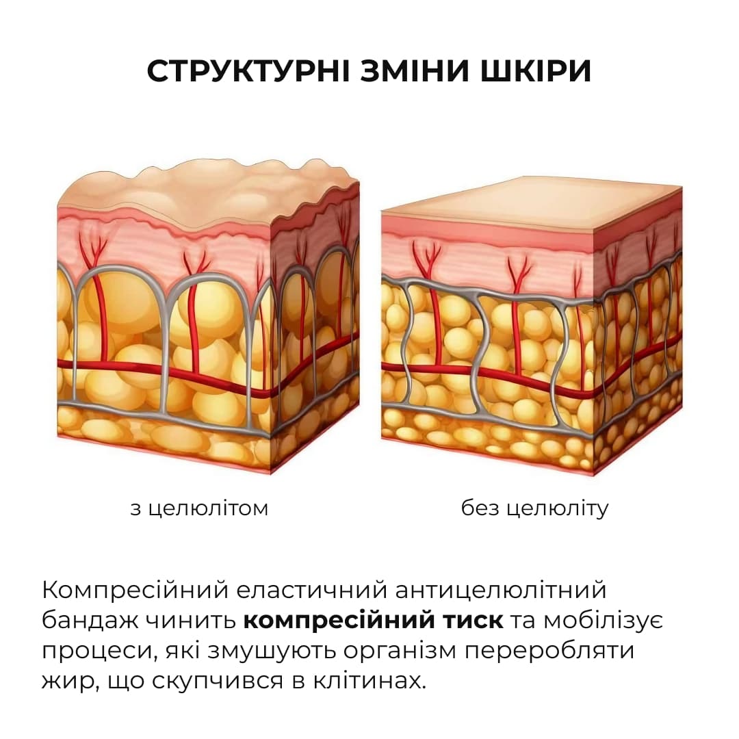 Курс антицелюлітних моделюючих обгортань з ашвагандою, 6 уп. thumbnail