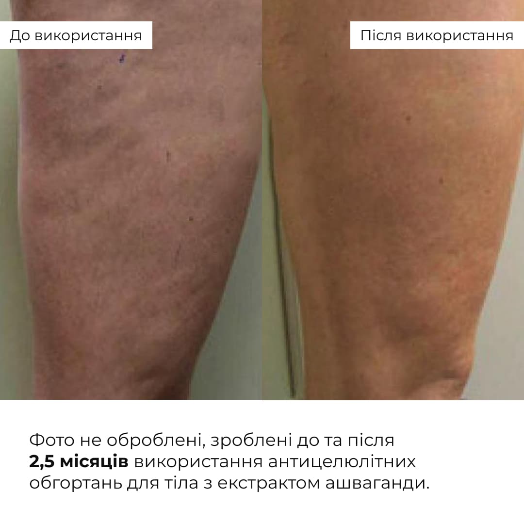 Комплекс антицелюлітних моделюючих обгортань з ашвагандою, 10 уп. thumbnail