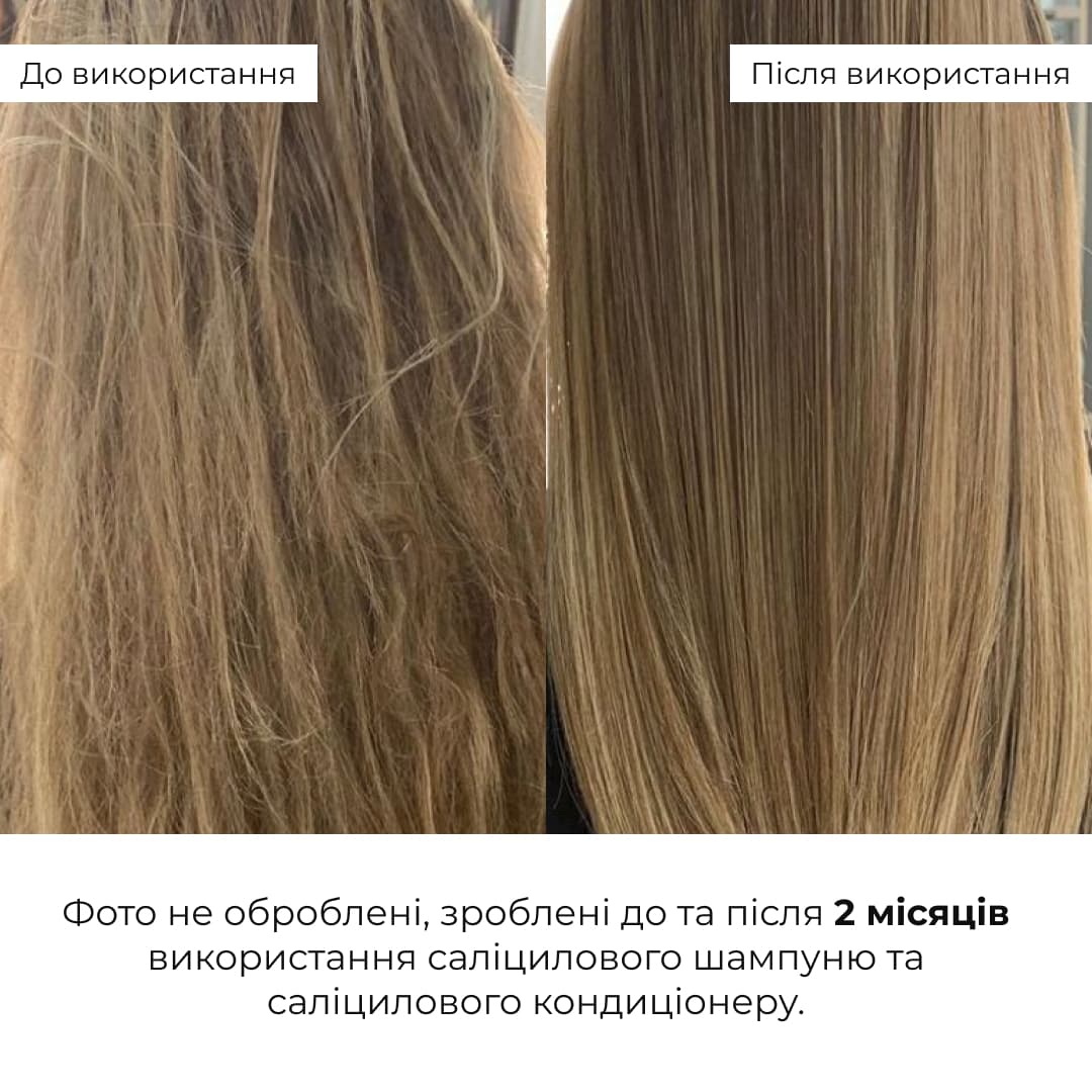 Набір для глибокого очищення та відновлення волосся і шкіри голови thumbnail