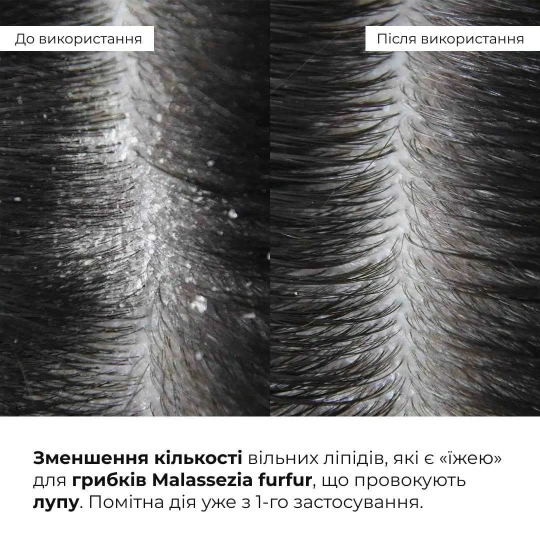 Набір для глибокого очищення та відновлення волосся і шкіри голови з термозахистом thumbnail