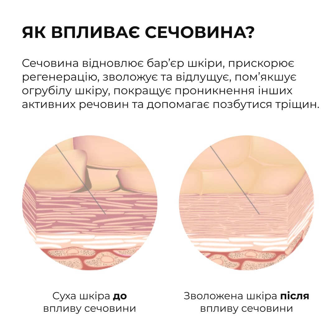 Комплекс для відлущування та корекції висипань на тілі thumbnail