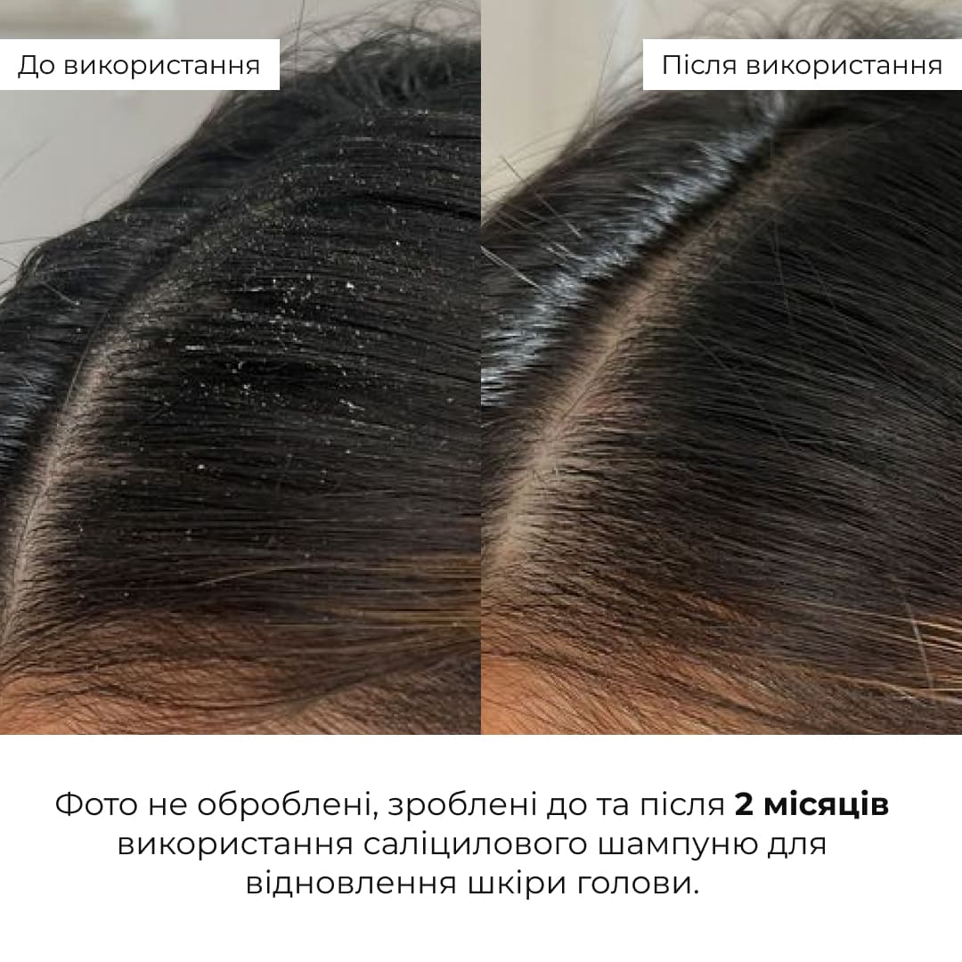 Набір для глибокого очищення та відновлення волосся і шкіри голови з термозахистом thumbnail