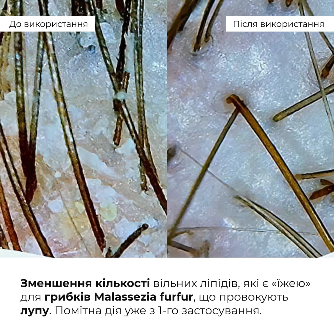 Набір для глибокого очищення та відновлення волосся і шкіри голови з термозахистом thumbnail