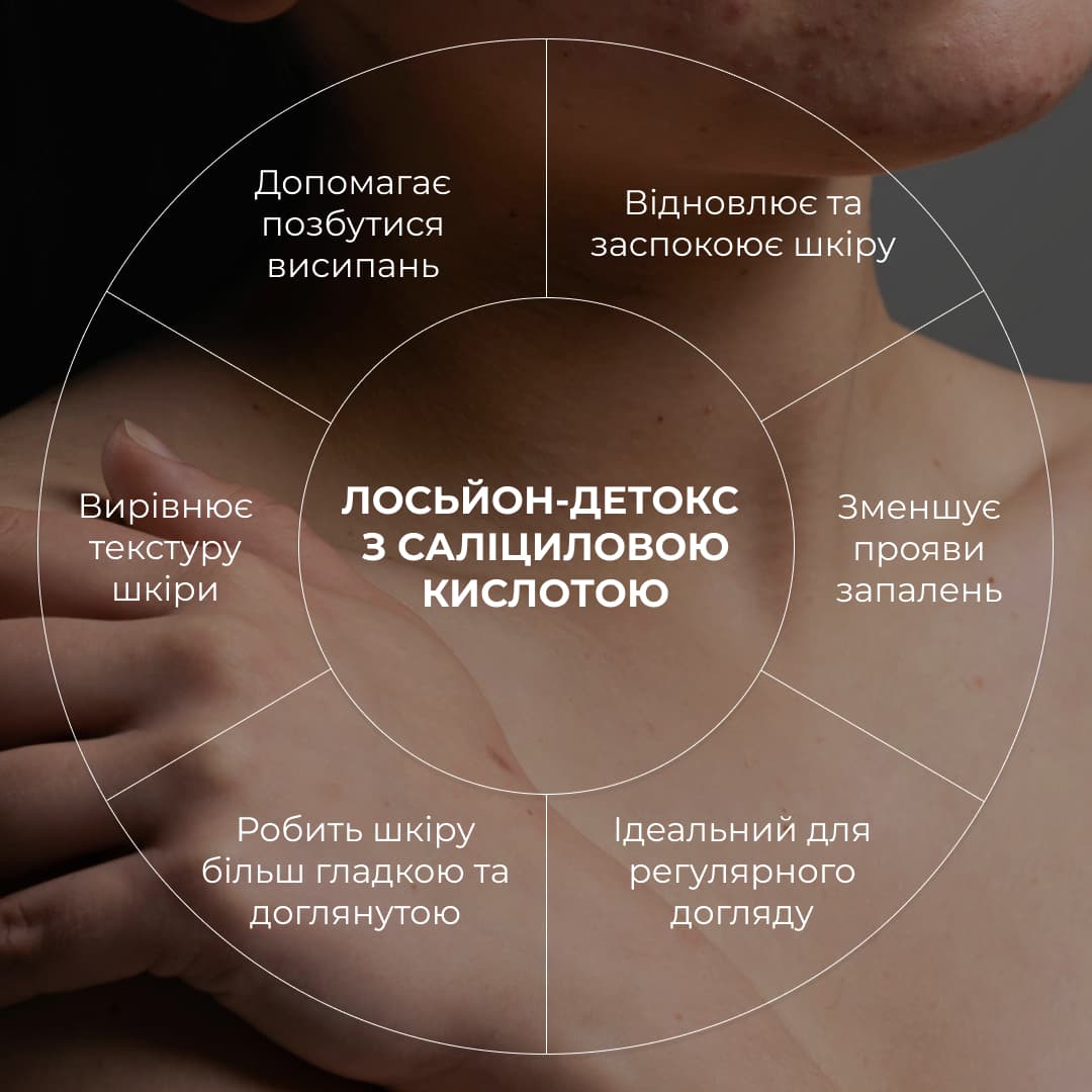 Комплекс проти висипань на тілі та глибокого живлення thumbnail