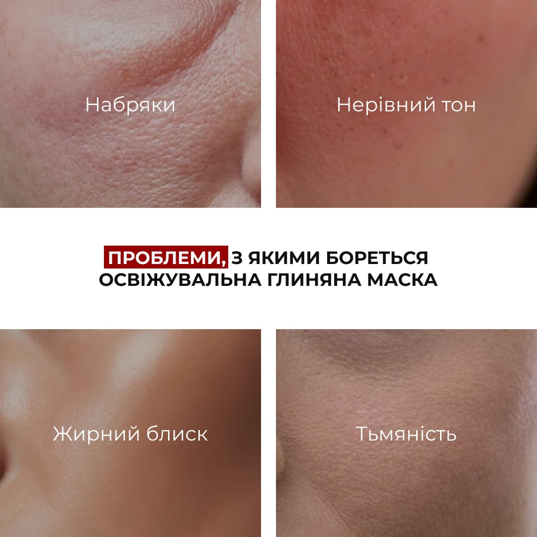 Комплекс глиняних масок для детоксикації та зменшення набряків thumbnail