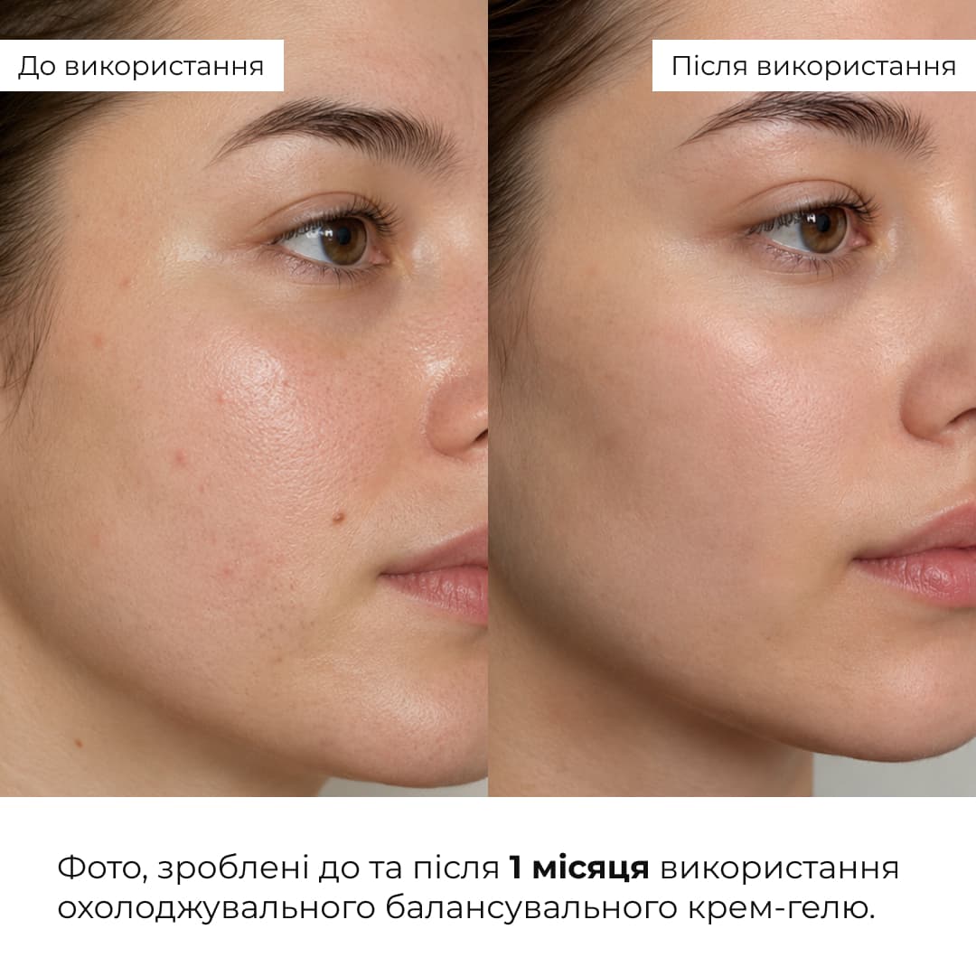 Комплекс щоденного догляду для жирної та комбінованої шкіри Hillary Daily Care Complex for Oily & Combination Skin thumbnail