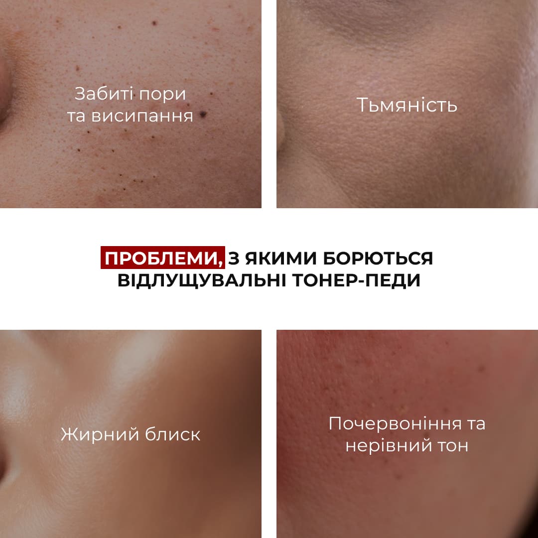 Комплекс для освітлення пігментних плям та захисту шкіри Hillary Dark Spot Brightening & Skin Protection Complex thumbnail