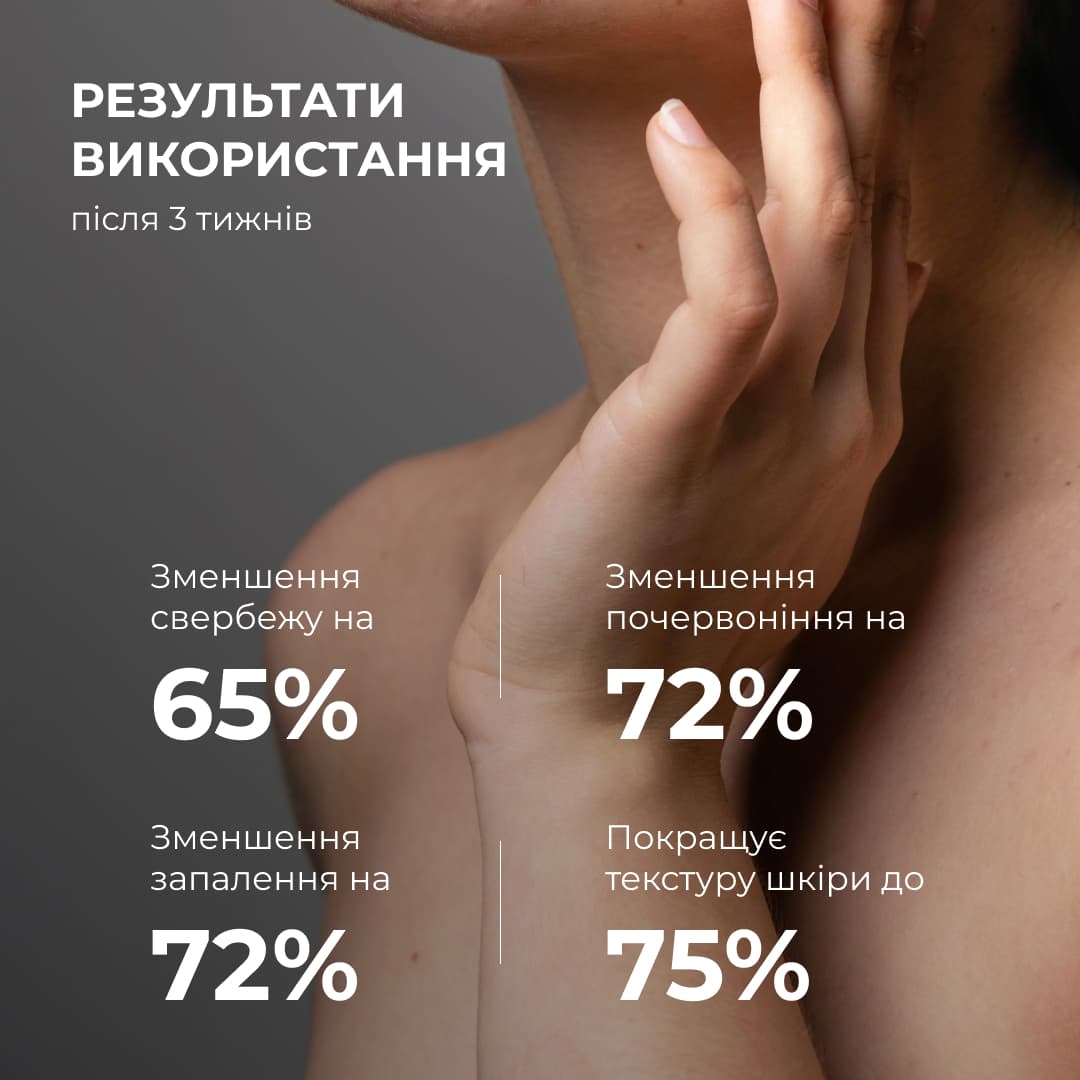 Лосьйон-детокс для проблемної шкіри з саліциловою кислотою, 150 мл thumbnail