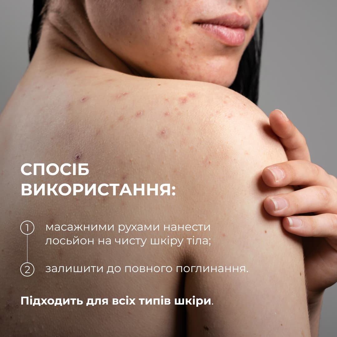 Лосьйон-детокс для проблемної шкіри з саліциловою кислотою, 150 мл thumbnail