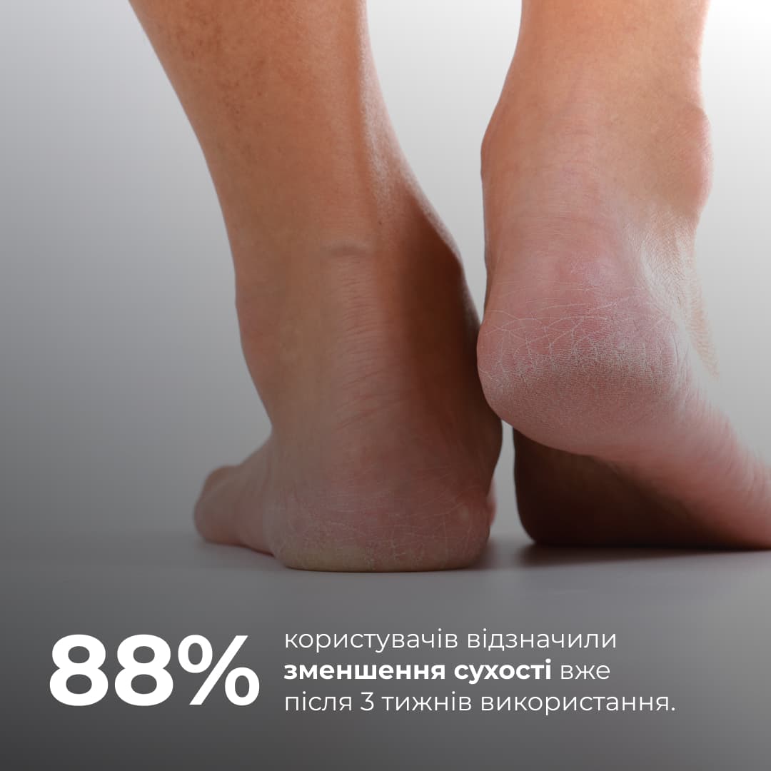 Набір для відновлення п'ят та свіжості стоп з розмарином і ромашкою thumbnail