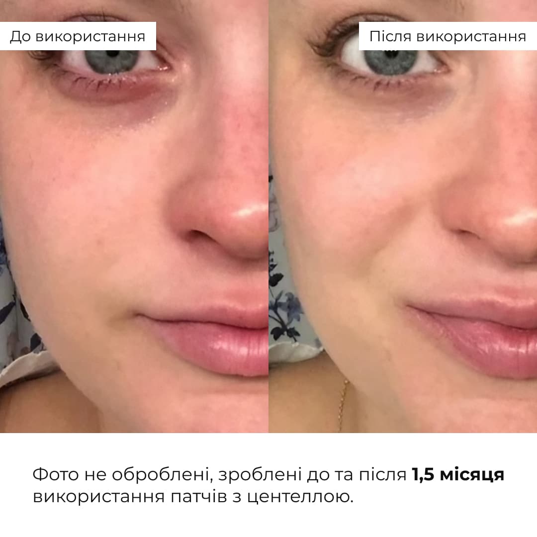 Набір із центеллою для заспокоєння та відновлення шкіри thumbnail