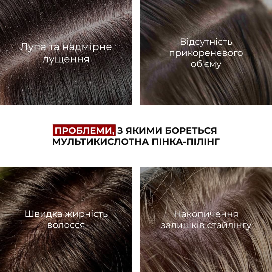 Набір для очищення шкіри голови та відновлення пошкодженого волосся HiLLARY thumbnail
