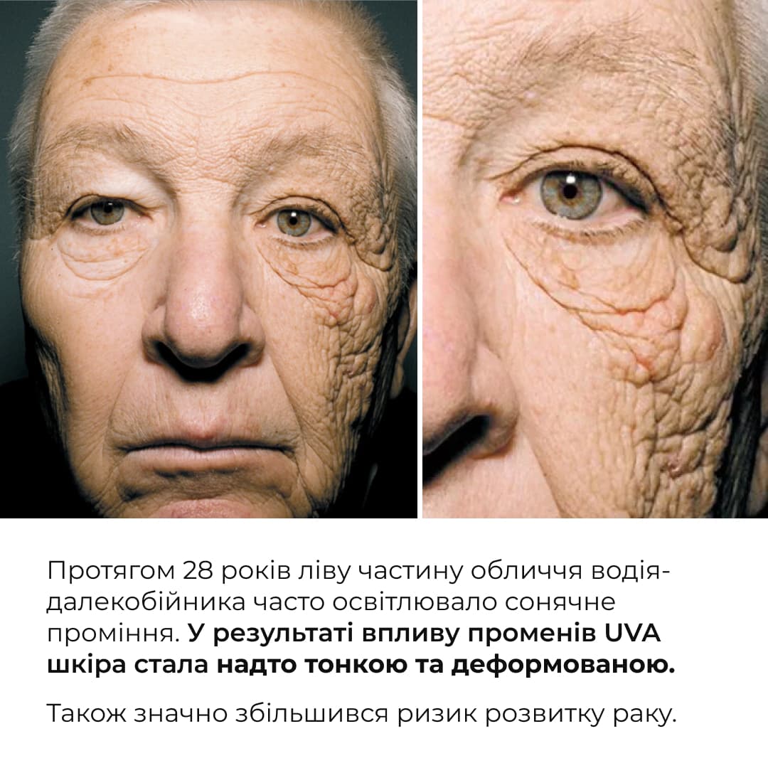 Сонцезахисний набір від фотостаріння для обличчя та тіла SPF 50+ (Hillary) thumbnail
