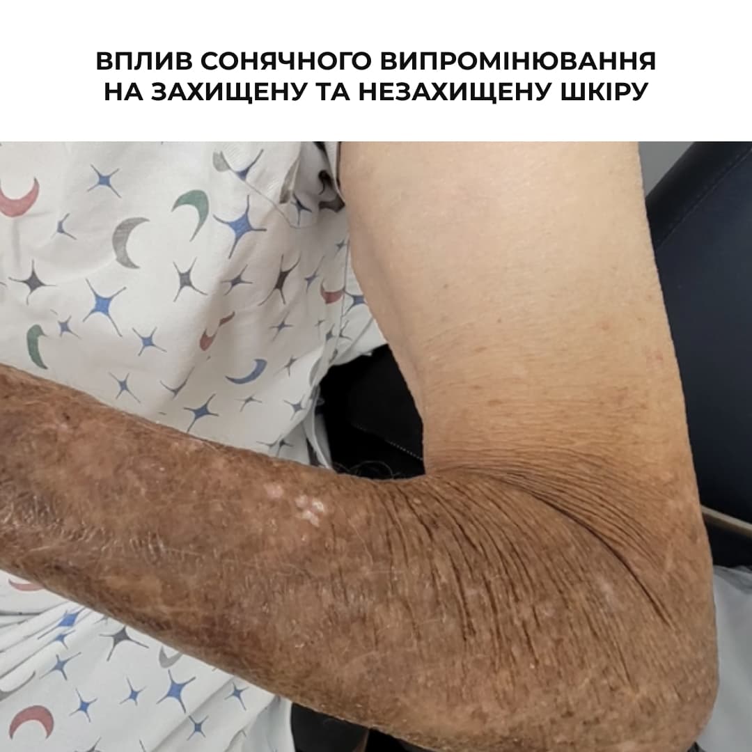 Вітамінний набір для зволоження та захисту обличчя і тіла з вітаміном С (Hillary) thumbnail