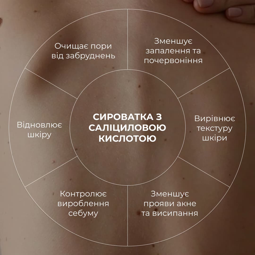 Набір для боротьби з акне на тілі з саліциловою кислотою thumbnail