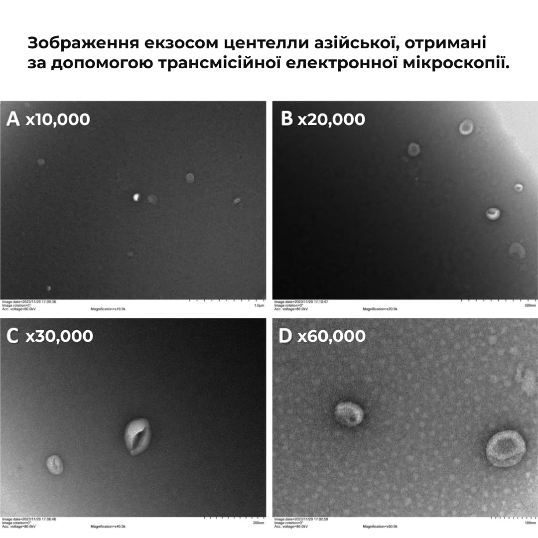 Набір інтенсивного догляду проти зморшок і почервоніння thumbnail