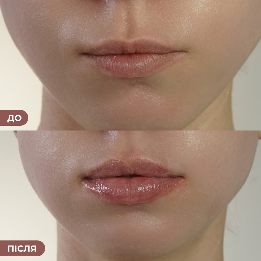 Набір блисків для інтенсивного зволоження та сяйва губ thumbnail