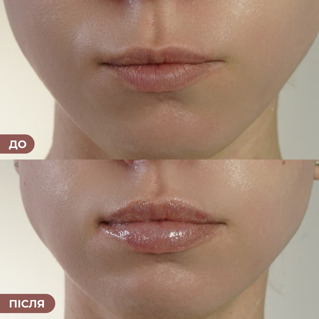 Набір блисків для інтенсивного зволоження та сяйва губ thumbnail