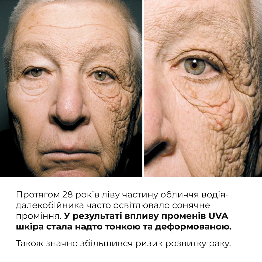 Комплекс для щоденного SPF захисту губ та обличчя Hillary Daily Lip & Face SPF Protection Complex thumbnail