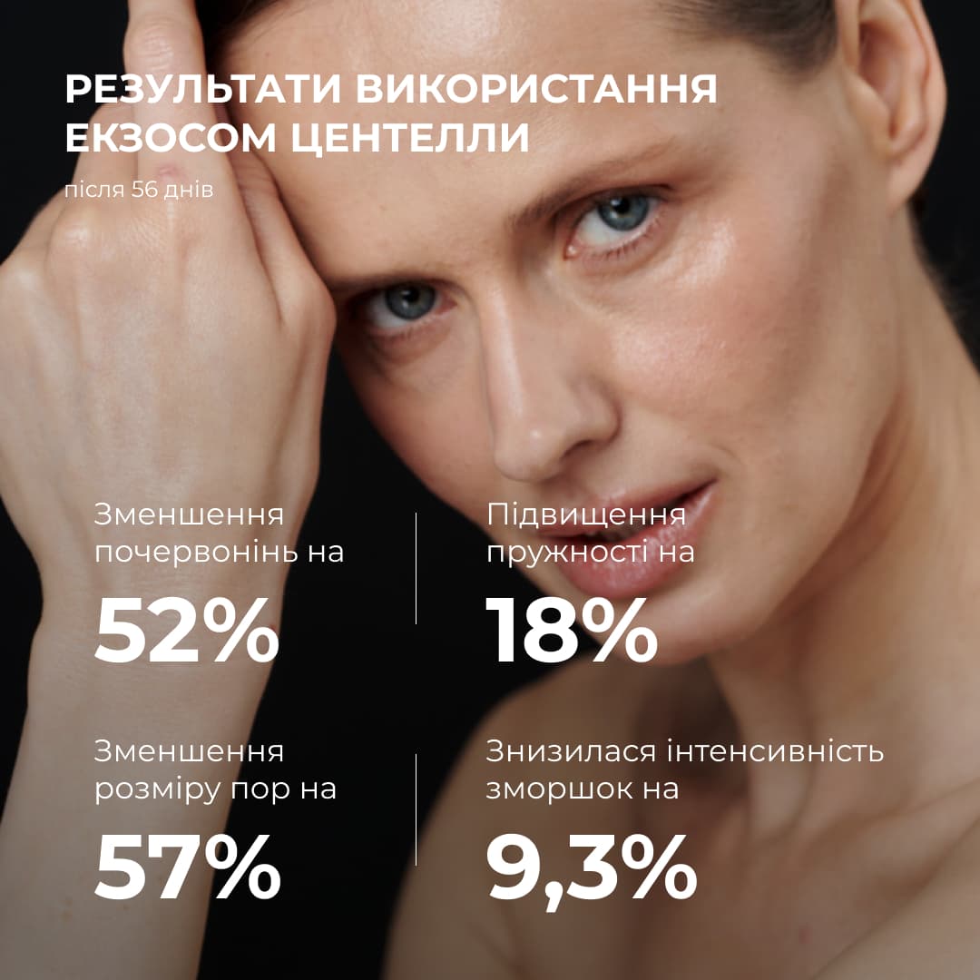 Пробник антигравітаційної моделюючої сироватки з екзосомами центелли, 2 мл thumbnail