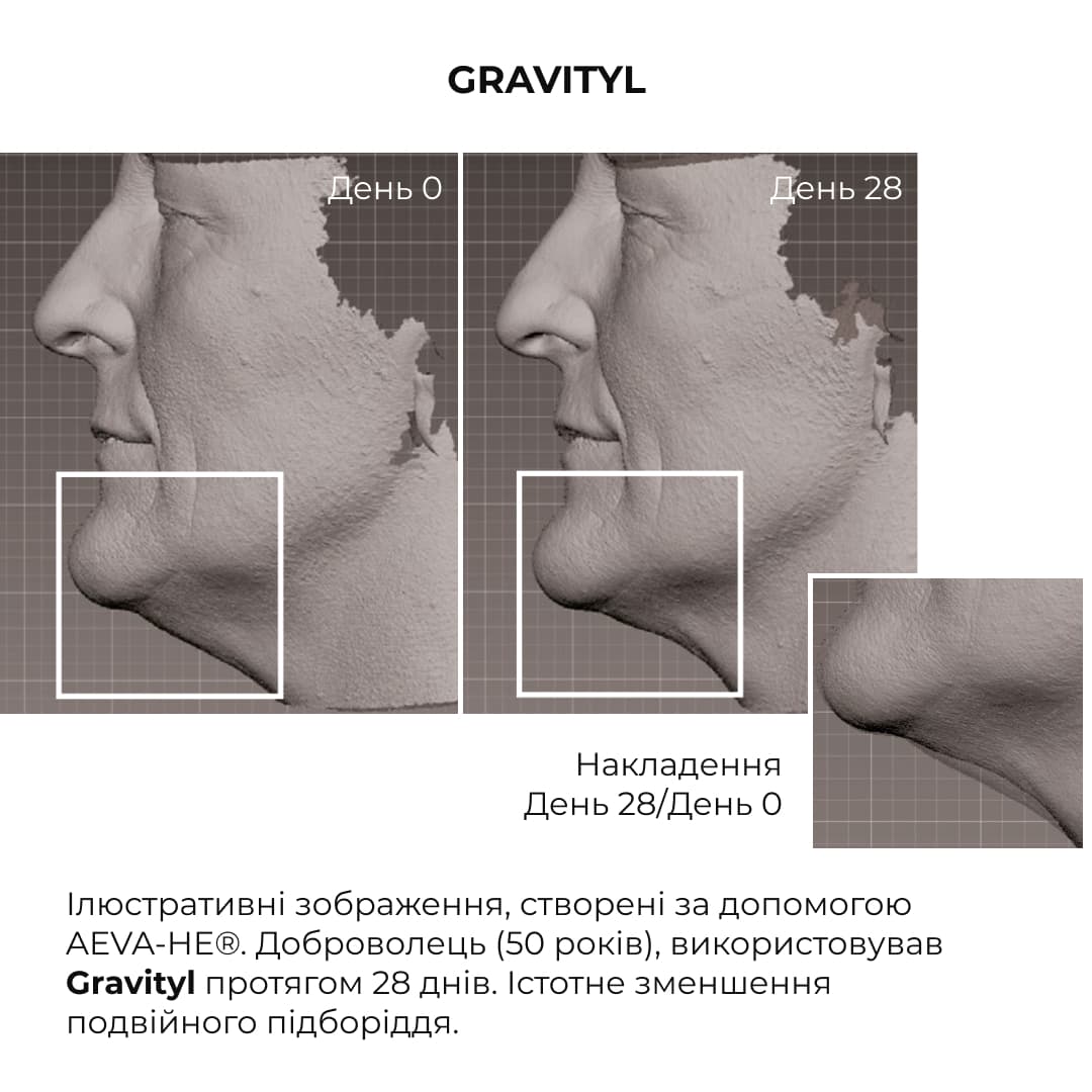 Пробник антигравітаційної моделюючої сироватки з екзосомами центелли, 2 мл thumbnail
