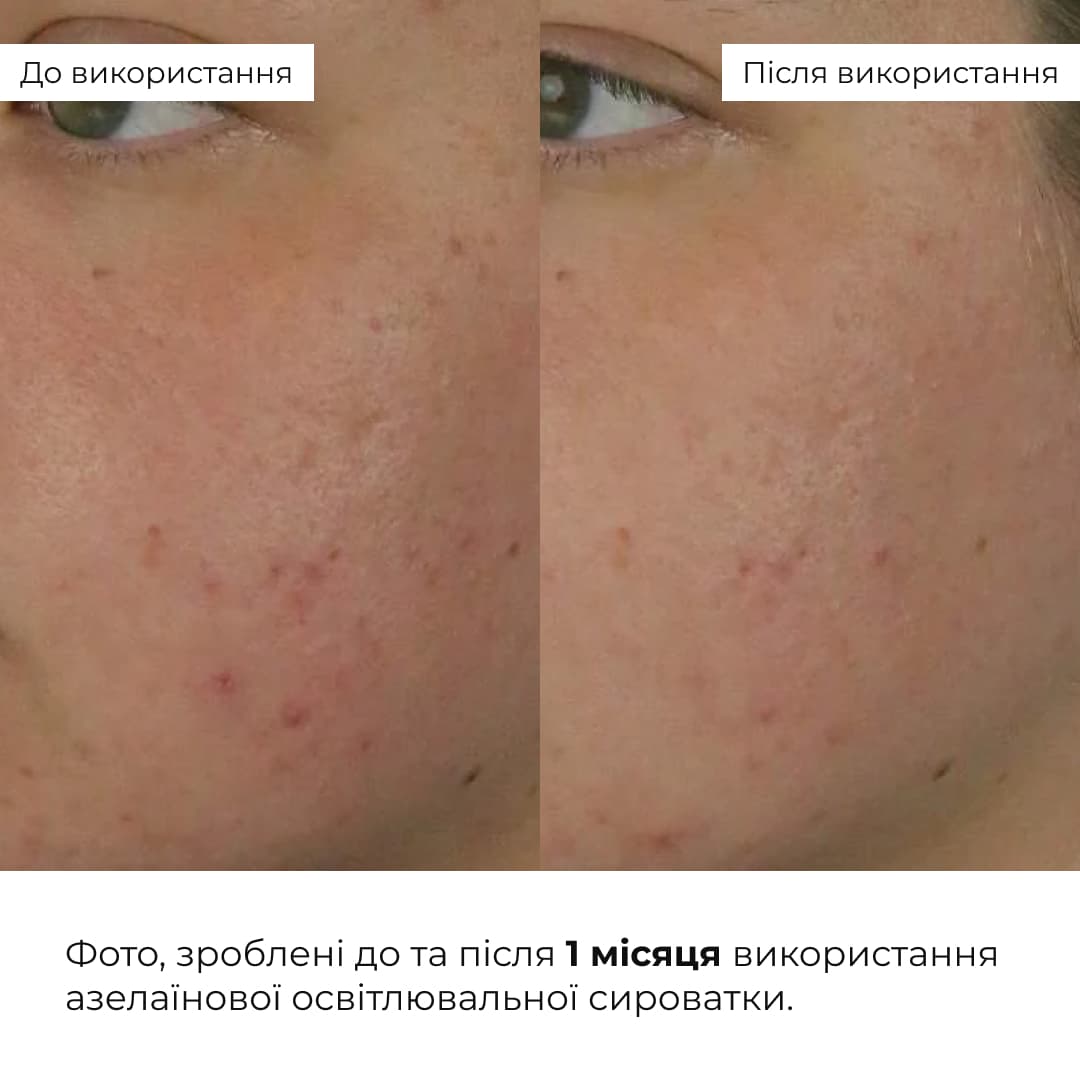 Комплекс для освітлення пігментації та захисту шкіри обличчя Hillary Pigmentation Brightening & Face Skin Protection Complex thumbnail