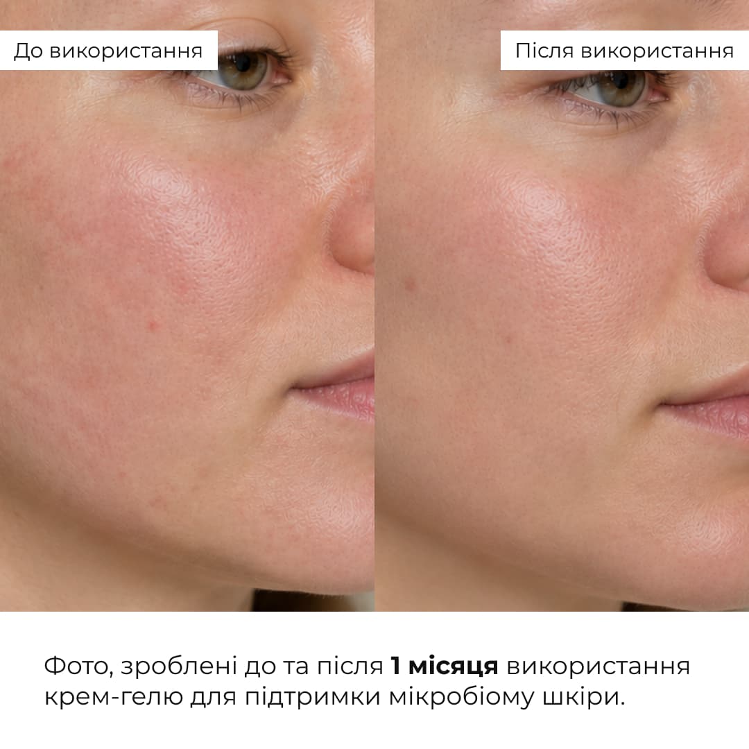Комплекс антивікового догляду для оновлення та розгладження текстури шкіри HiLLARY thumbnail