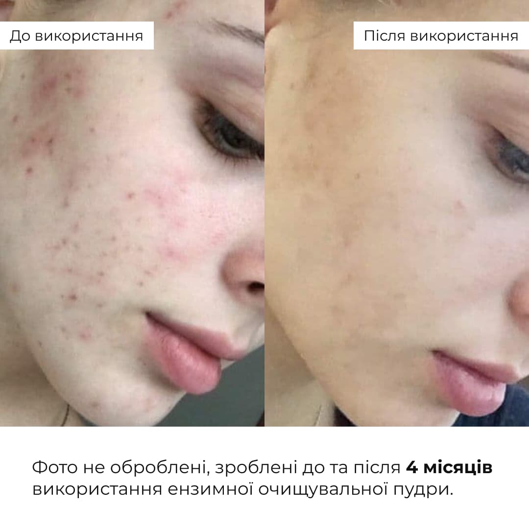 Набір для чутливої та сухої шкіри з центеллою і пробіотиками thumbnail