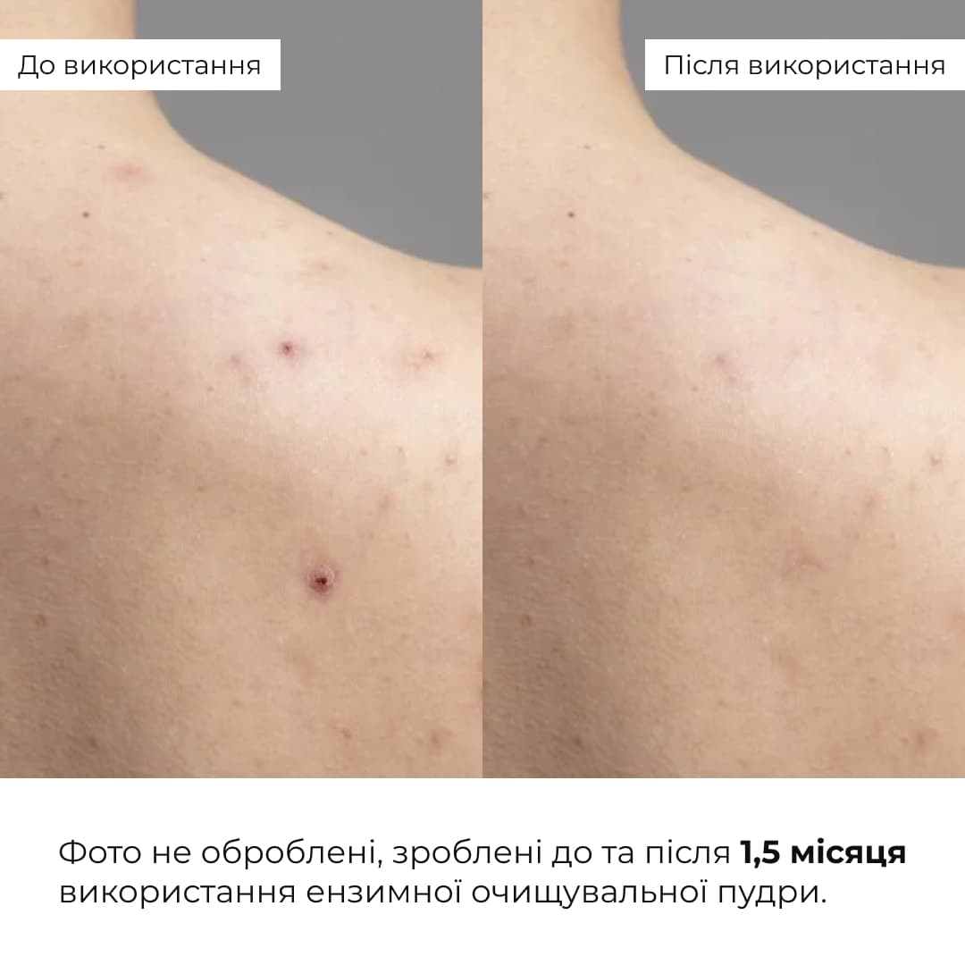 Набір для чутливої та сухої шкіри з центеллою і пробіотиками thumbnail