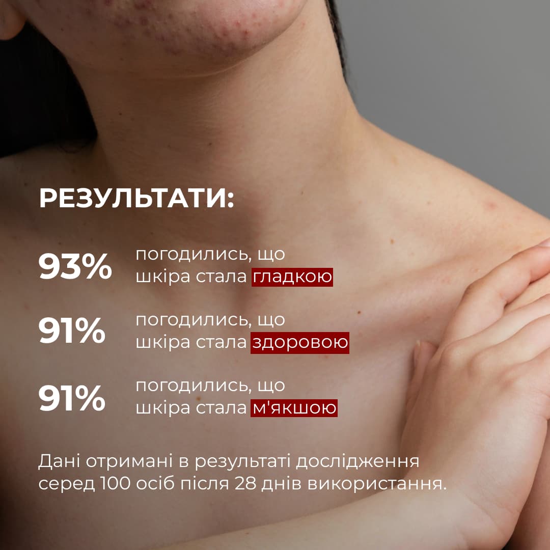 Набір для зниження висипань на тілі та делікатного очищення інтимної зони thumbnail