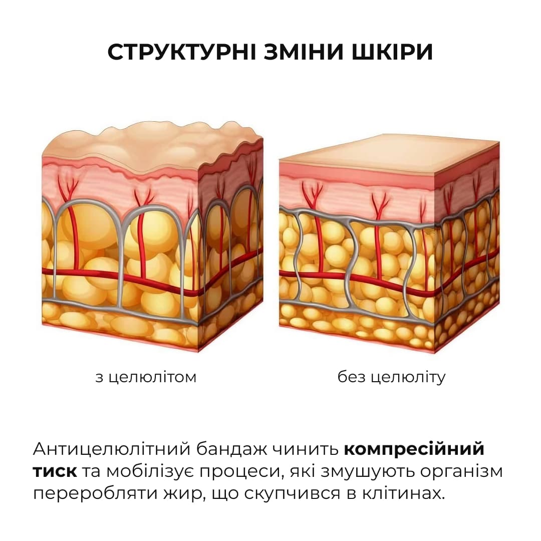 Антицелюлітний експрес комплекс Hillary Anti-Cellulite EXPRESS Sculpt Complex thumbnail
