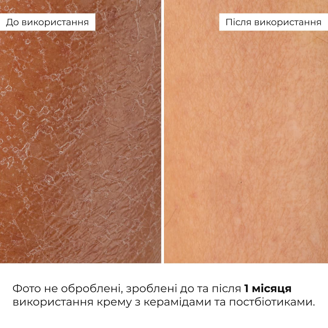 Комплекс базового догляду для оновлення та захисту шкіри thumbnail