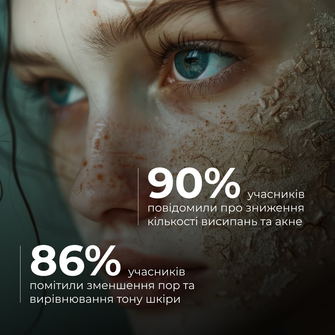 Комплекс нічного догляду для себорегуляції та корекції висипань thumbnail