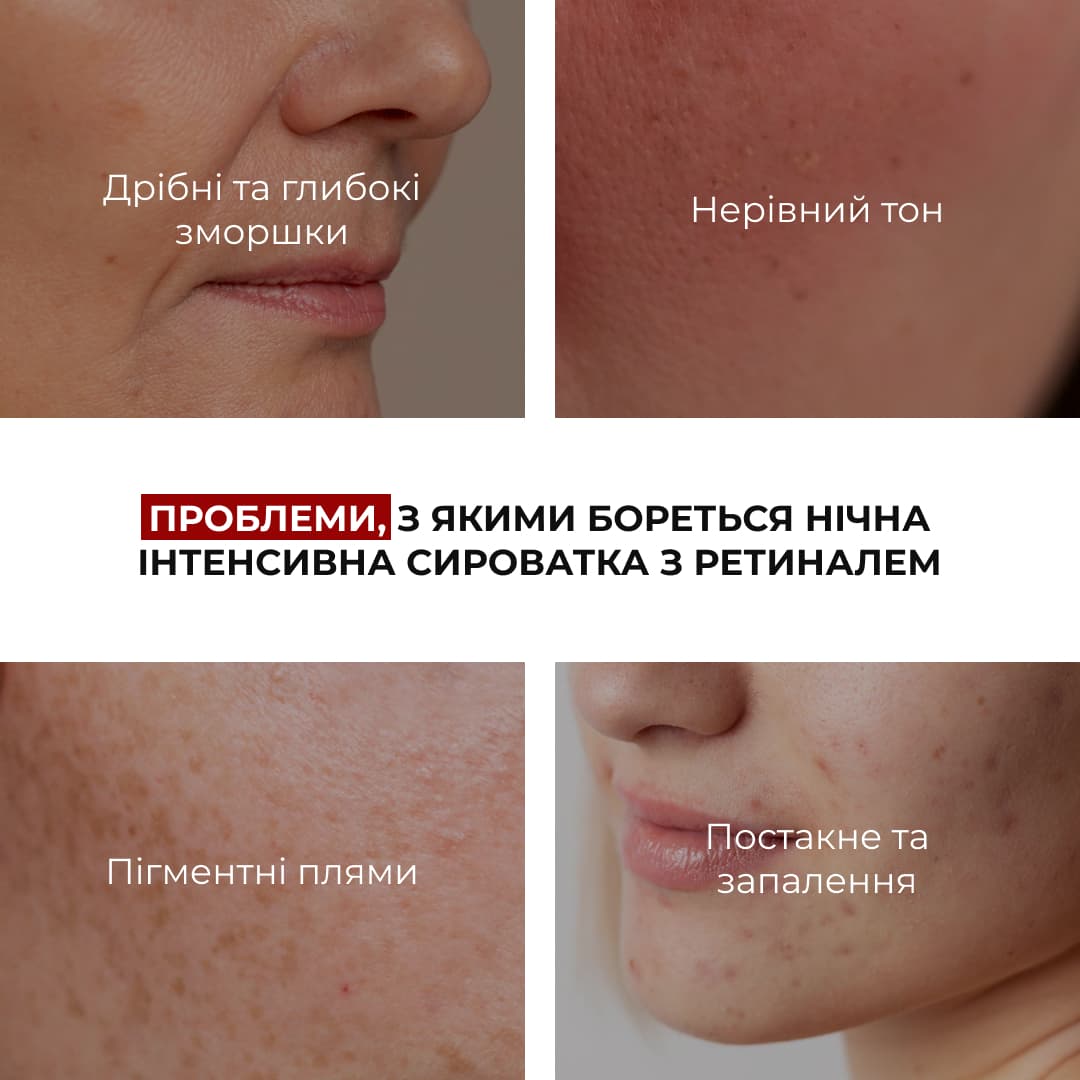 Комплекс нічного догляду для себорегуляції та корекції висипань thumbnail